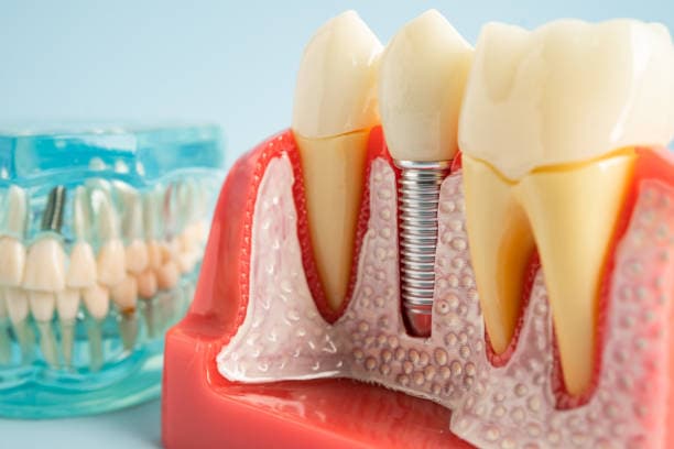 prosthodontics