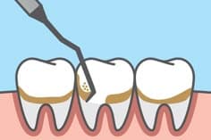 periodontics