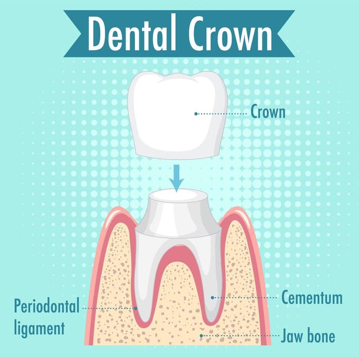 Prosthodontics